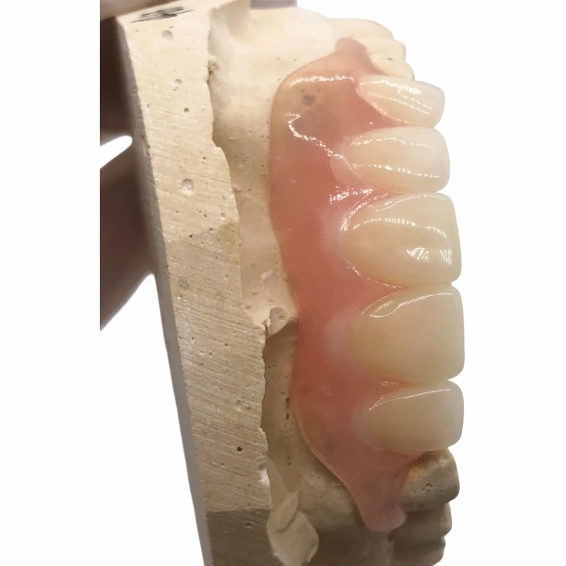 Dental RPD Fleksib Patial Dantè